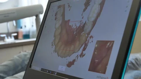 3D Scan of Teeth Stock Footage 202110488