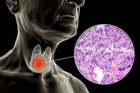 A 3D scientific illustration showcasing a human body with transparent skin, r Stock Illustration