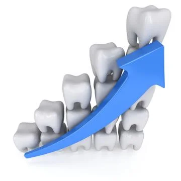 3d teeth bar graph with blue arrow Stock Illustration