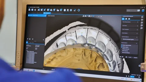 3D teeth scanner results on screen Stock Footage 99923030