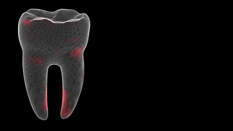 3D tooth Scan. Tooth Scanning Interface.... | Stock Video | Pond5