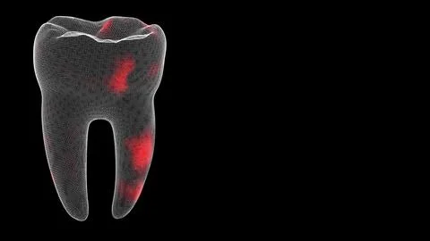 3D tooth Scan. Tooth Scanning Interface. HUD Tooth analyze. Medical Science.. Illustrazione stock