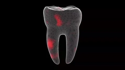 3D tooth. Toothache Scanning Interface. HUD Tooth analyze. Medical Anatomy .. Stock Illustration