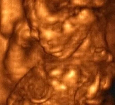 3D Ultrasonography Analysis of a 4th Month Fetus Stock Illustration