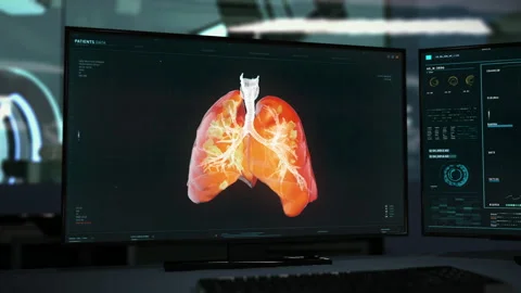 3D Visualisation Of Lungs In Modern Diagnostics Software On The Computer Screen Stock Footage 210238335