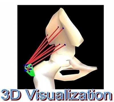 3D Visualization of Anatomical Pathways with Precision Laser Beams for Adva.. Stock Photos