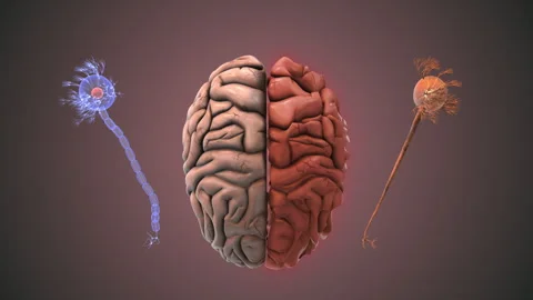 3D Visualization Showing Healthy Versus Alzheimers Brain Stock Footage 323582762