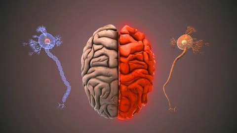 3D Visualization Showing Healthy Versus Alzheimers Brain Stock Illustration
