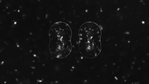 3D visualization of the virus. Pathogens, information on the new 2019-nCoV Stock Footage 160124273