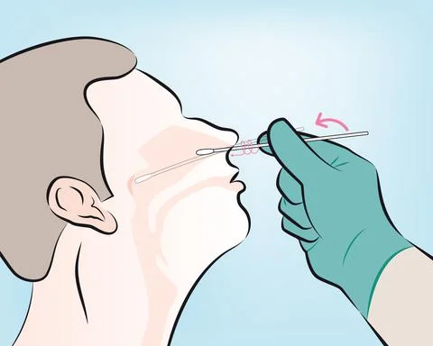 4-insert the swab into the nostril Stock Illustration