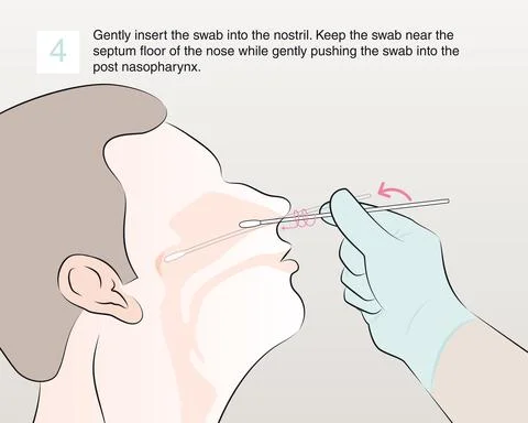 4-insert the swab into the nostril Illustration
