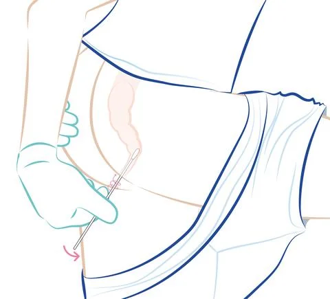 4-insert the swab into the rectum Stock Illustration