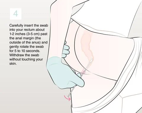 4-insert the swab into the rectum Stock Illustration