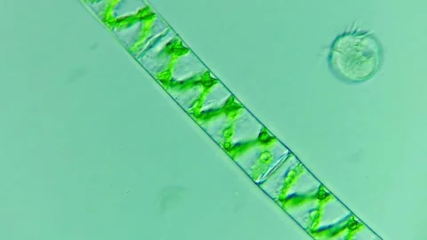 400x Microscopic View of Spirogyra Algae — Freshwater Micro World in Detail Stock Footage 314634193