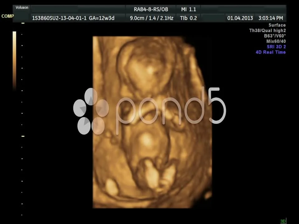 4d baby ultrasound las vegas