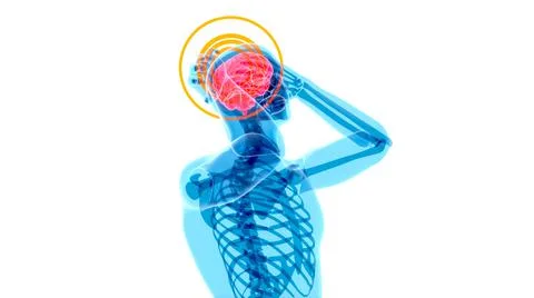 4K anatomy concept of a headache イラスト素材
