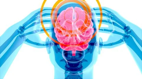 4K anatomy concept of a headache イラスト素材