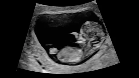 4k Baby in womb Stock Footage 336626828