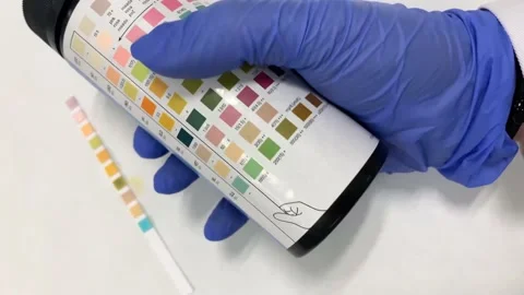 4K Close Up of Checking Urine Test Strips With the Bottle Vídeo Stock 135852033
