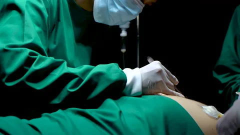 4K, Close-up doctor's hand waiting receive knife from nursing assistant, do.. Stock Footage 237584000