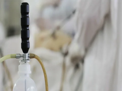 4K Close-up Laparoscopic surgery of the abdomen. Stock Footage 74841258