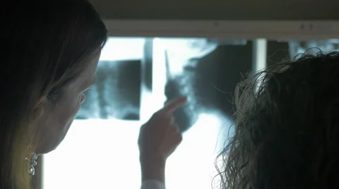 4k Closeup of Chiropractor, Patient, X-Ray Stock Footage 40296580