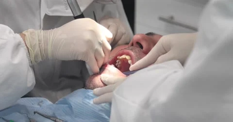 4k Dentist making professional teeth cleaning male patient at the dental clinic. Stock Footage 147322429