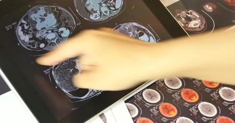 4k doctor study Mri Scanner on ipad,head &amp; organ pet-ct. 库存影片 48990003