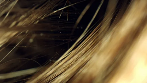 4k Extreme Close-up, Microscopic View of Human Hair Stock Footage