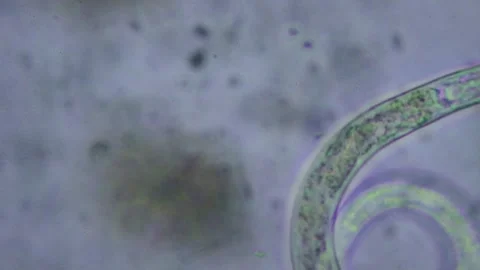 4k footage of a nematode under a microscope at different magnification Stock Footage 255983834