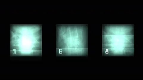 4k Human finger bone scan,tech medical X-ray data,medical research body health. Stock Footage 46848866