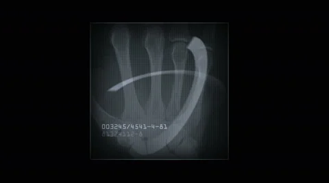 4k Human finger bone scan,tech medical X-ray data,medical research body health. Stock Footage 46861145