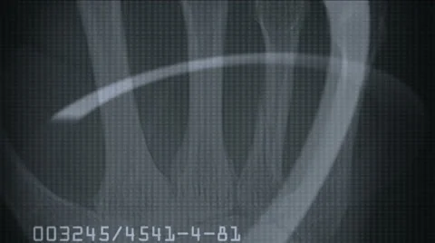 4k Human finger bone scan,tech medical X-ray data,medical research body health. Stock Footage 46863626