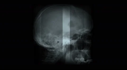 4k Human head bone skeleton skull X-ray scan,medical research body health&amp;death Stock Footage 46853509