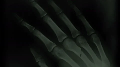 4k Human rib finger bone scan,tech medical X-ray,medical research,body health. Stock Footage