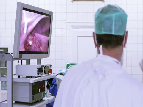 4K Laparoscopic surgery of the abdomen. Stock Footage 73884147