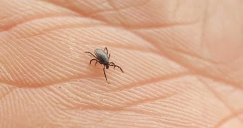 4K macro shot on tick walking on human skin Stock Footage 158289576