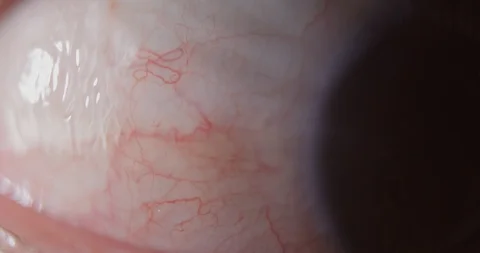 4k macro slow motion shot of a eye ball looking sideways revealing the veins. Stock Footage 106257345