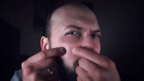 4K Man Looking in Mirror and Squeezing Pimple Stock Footage 78214409