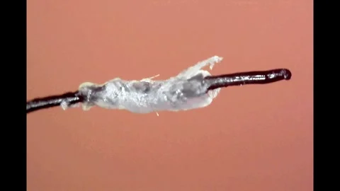 4K Microscope view of hair removal from the root Stock Footage 332848556