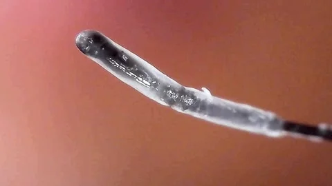 4K Microscope view of hair removal from the root Stock Footage 332848579