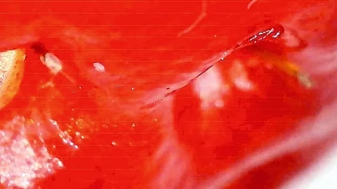 4K Microscopic Close-up of Fresh Strawberry Surface and Seeds #2 Stock Footage 334204699