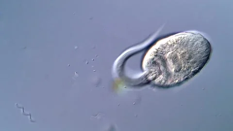 4K Microscopic Footage of Trematode Larvae in Water Vidéo 317222680