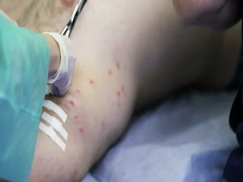 4K The nurse puts a plaster on the wound after surgery. Stock Footage 73392848
