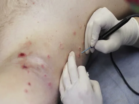 4K Plastic surgery. Stock Footage 73392631
