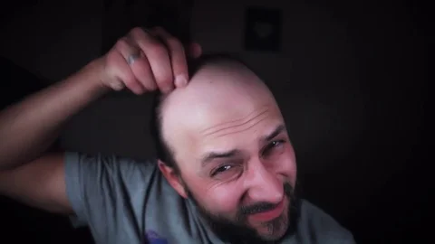 4K Portrait Man Looking in Mirror at his Bald Head Video stock 78212900