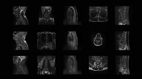 4k set spine MRI, a real  tomography of the spine, Magnetic resonance imaging. Stock Footage 63229853