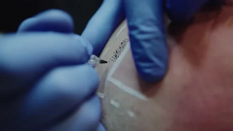 4k shot of Scalp Tattoo Dot Stock Footage 207045298