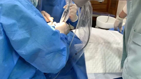 4k Side view of dentist and dental assistants' during dental implant surgery Stock Footage 136066620