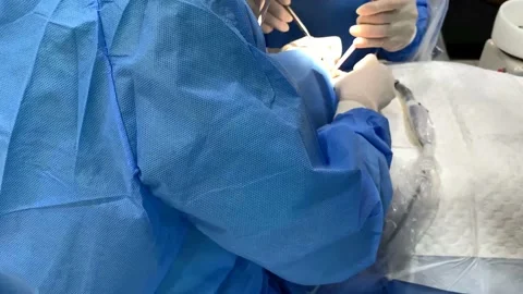 4k Side view of dentist and dental  implant  assistants' during surgery Stock Footage 152705633